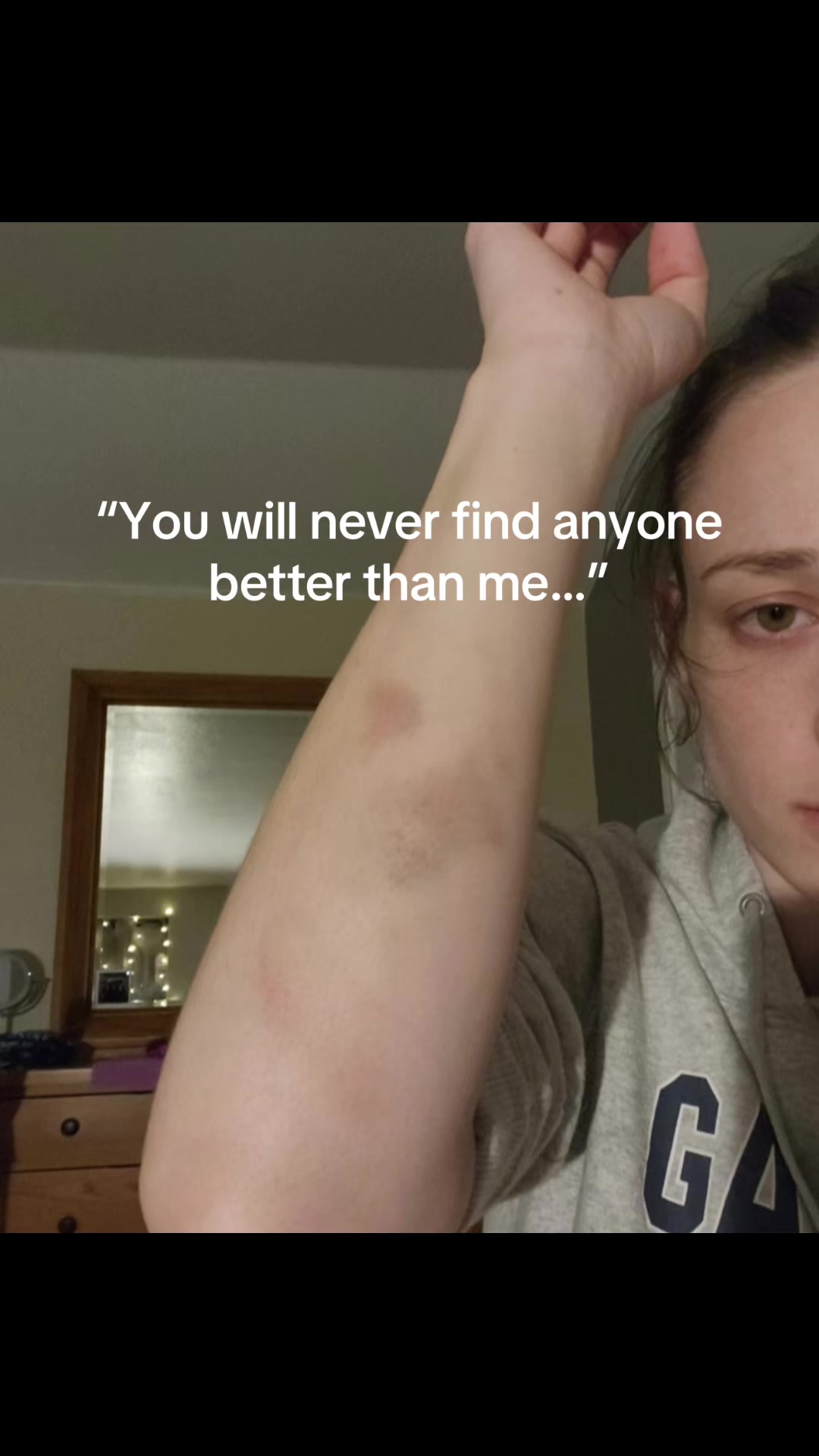 @SurvivingDv