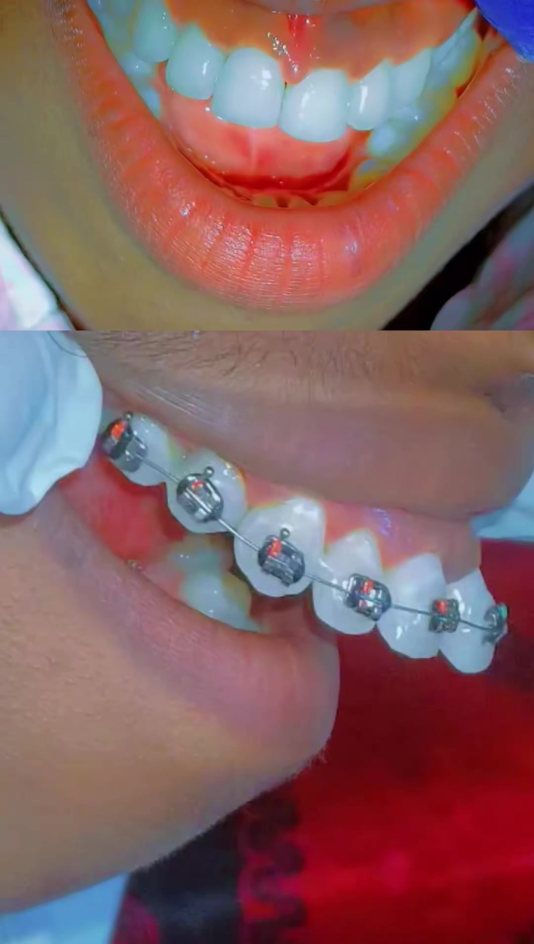 @Dr.Naasir🦷🩵🩺