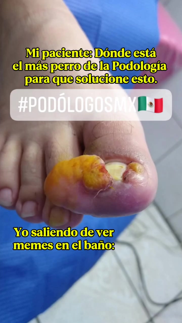 @PodólogosMx