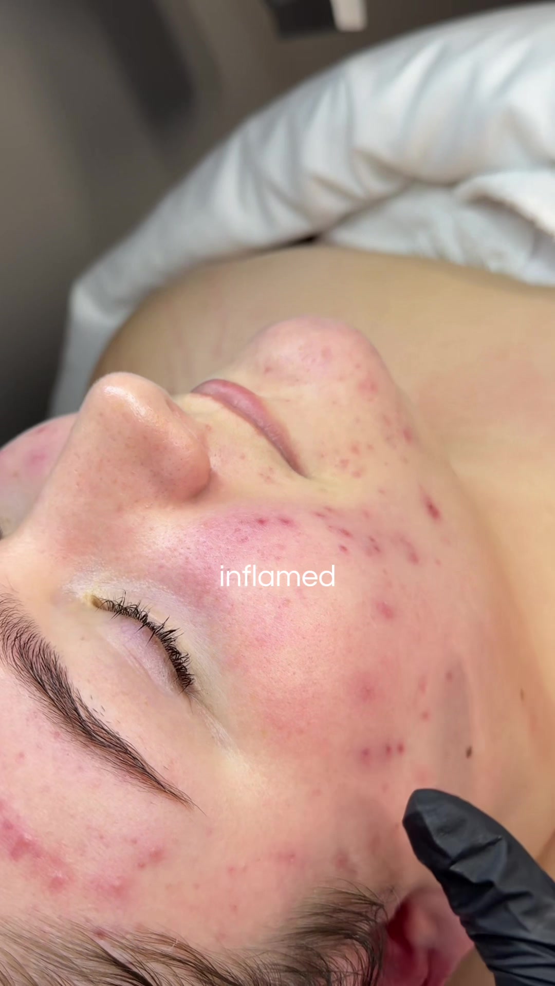 @Skinformative