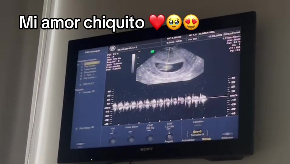 @Cristigimegpy