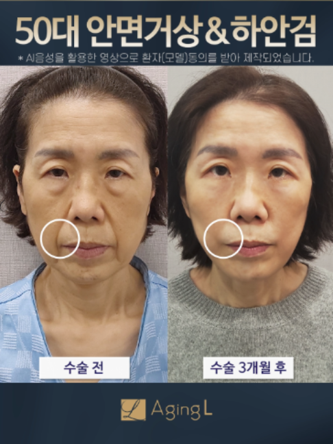 @agingl_official