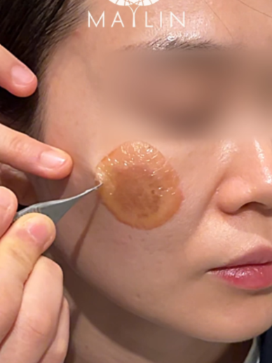 @메이린의원대구점