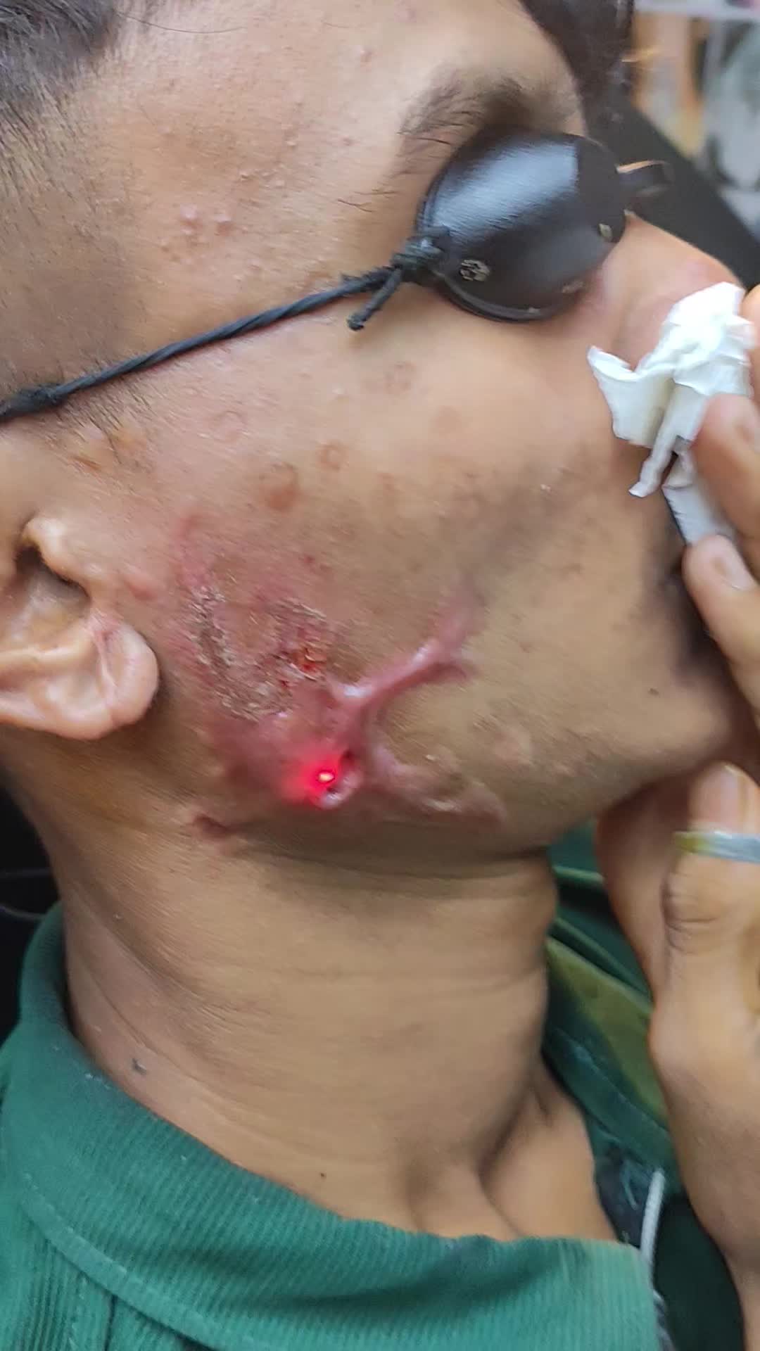@đŠī¸TATTOO STUDIO DHANMONDI đĻŠ