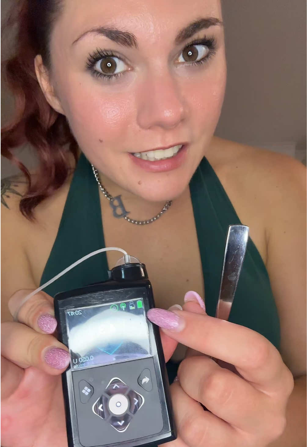 @Barbara Štimac | T1D 💙