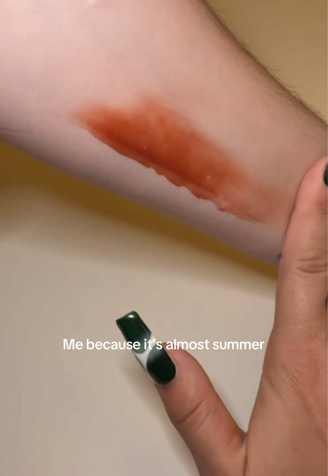 @HF