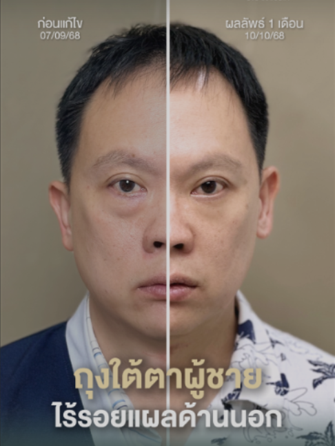 @atier.eyesurgery