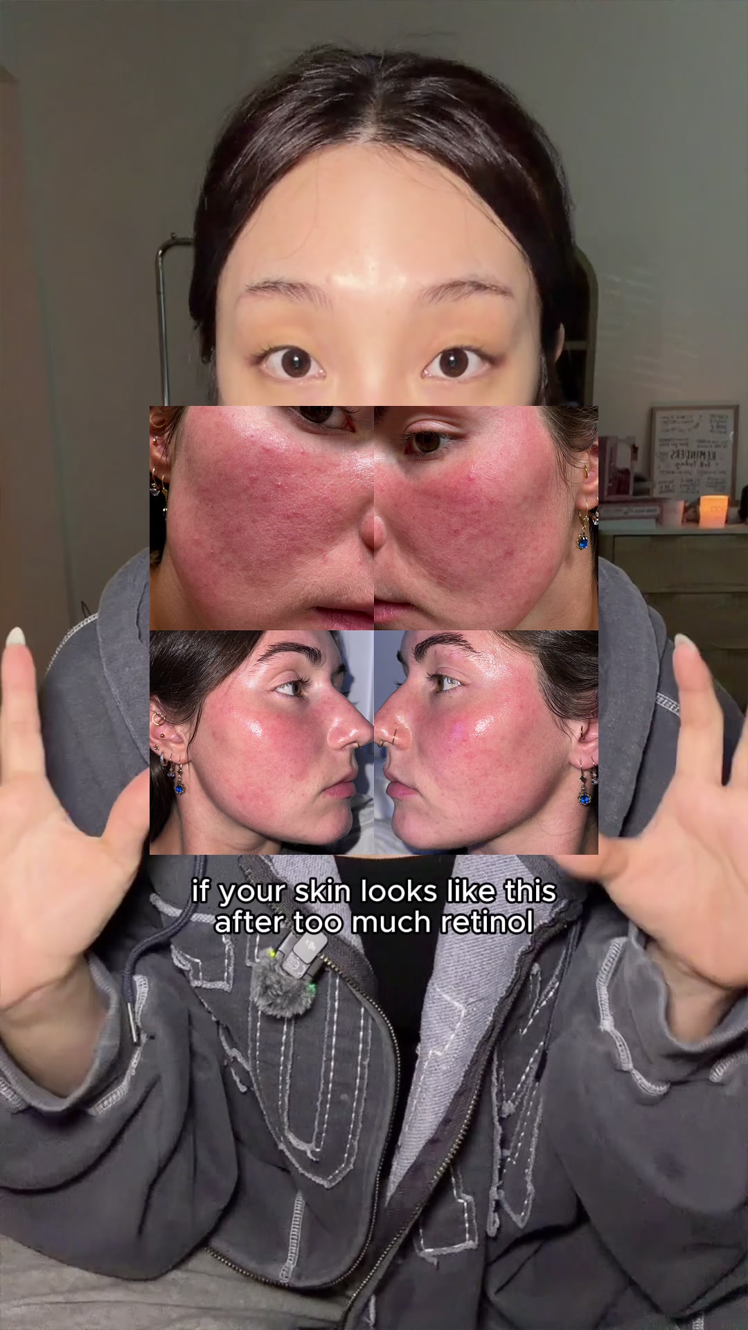 @lily