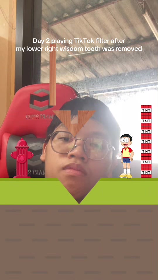 @MisterOX