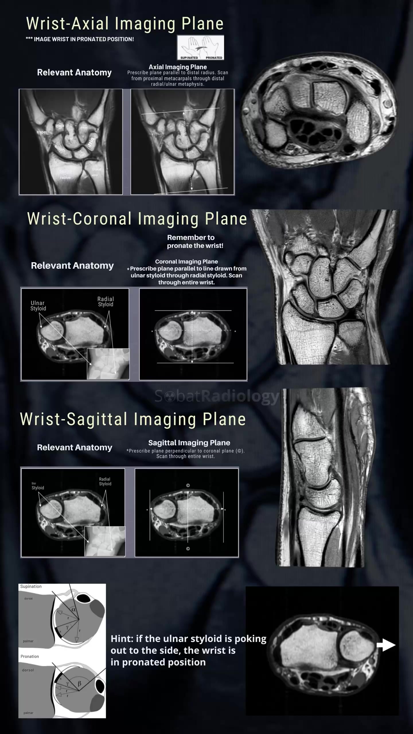 @Sobat Radiology