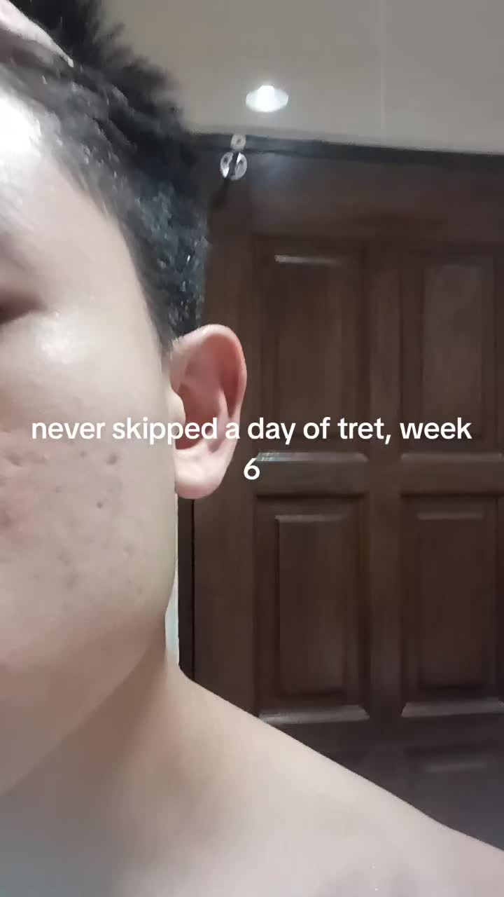 @asscancernecromancer