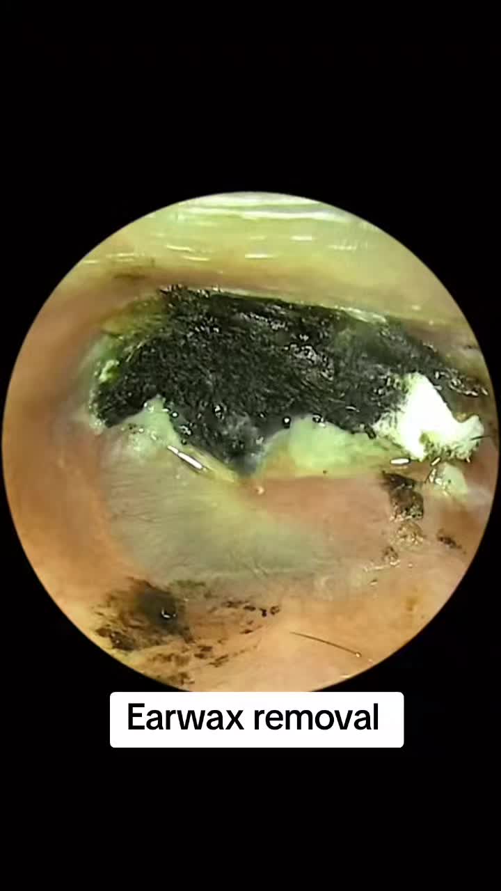 @Earwax.pro