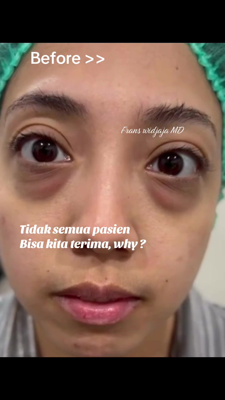 @FransHerywidjaja MD