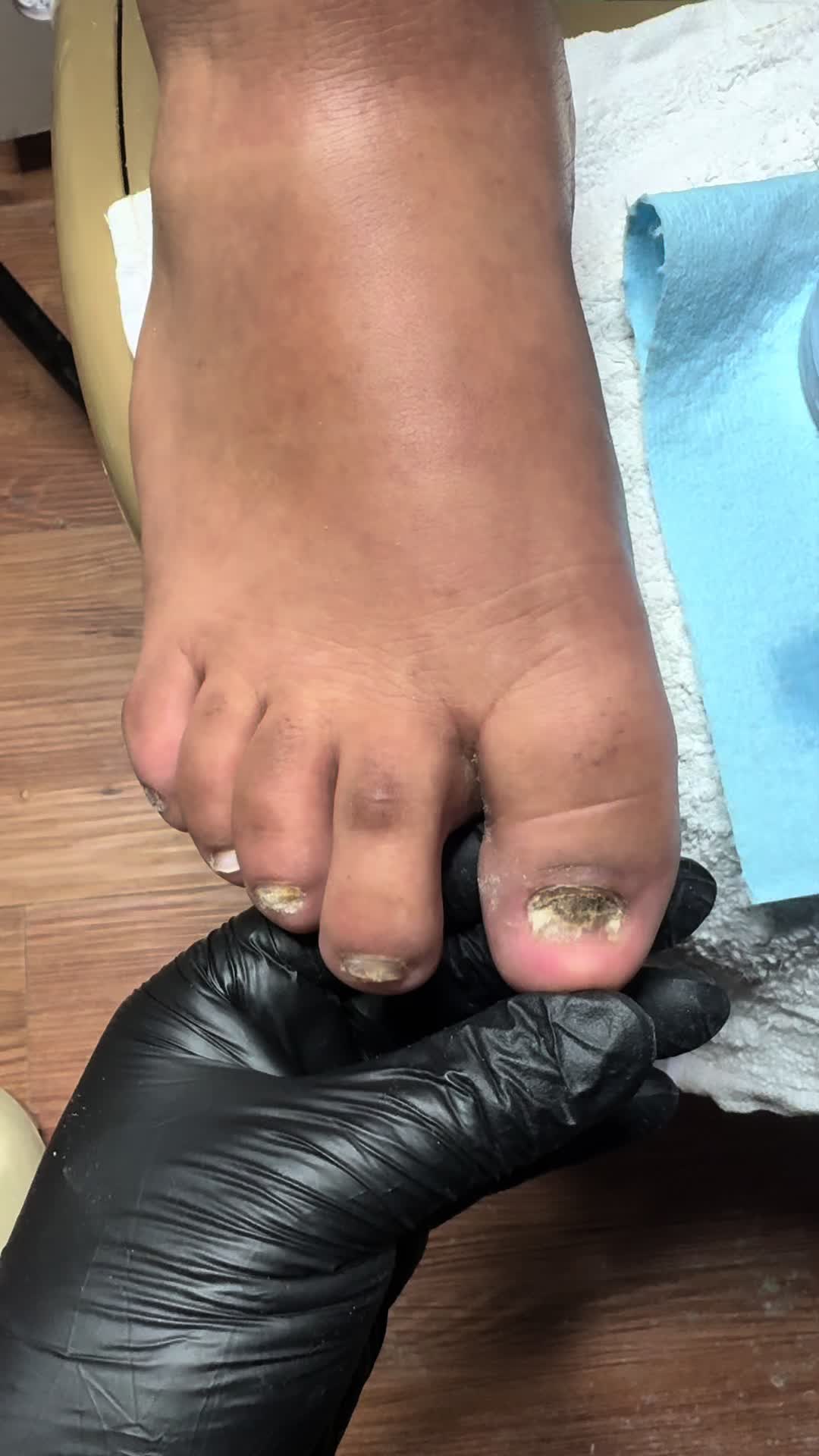 @ToesbyKoki