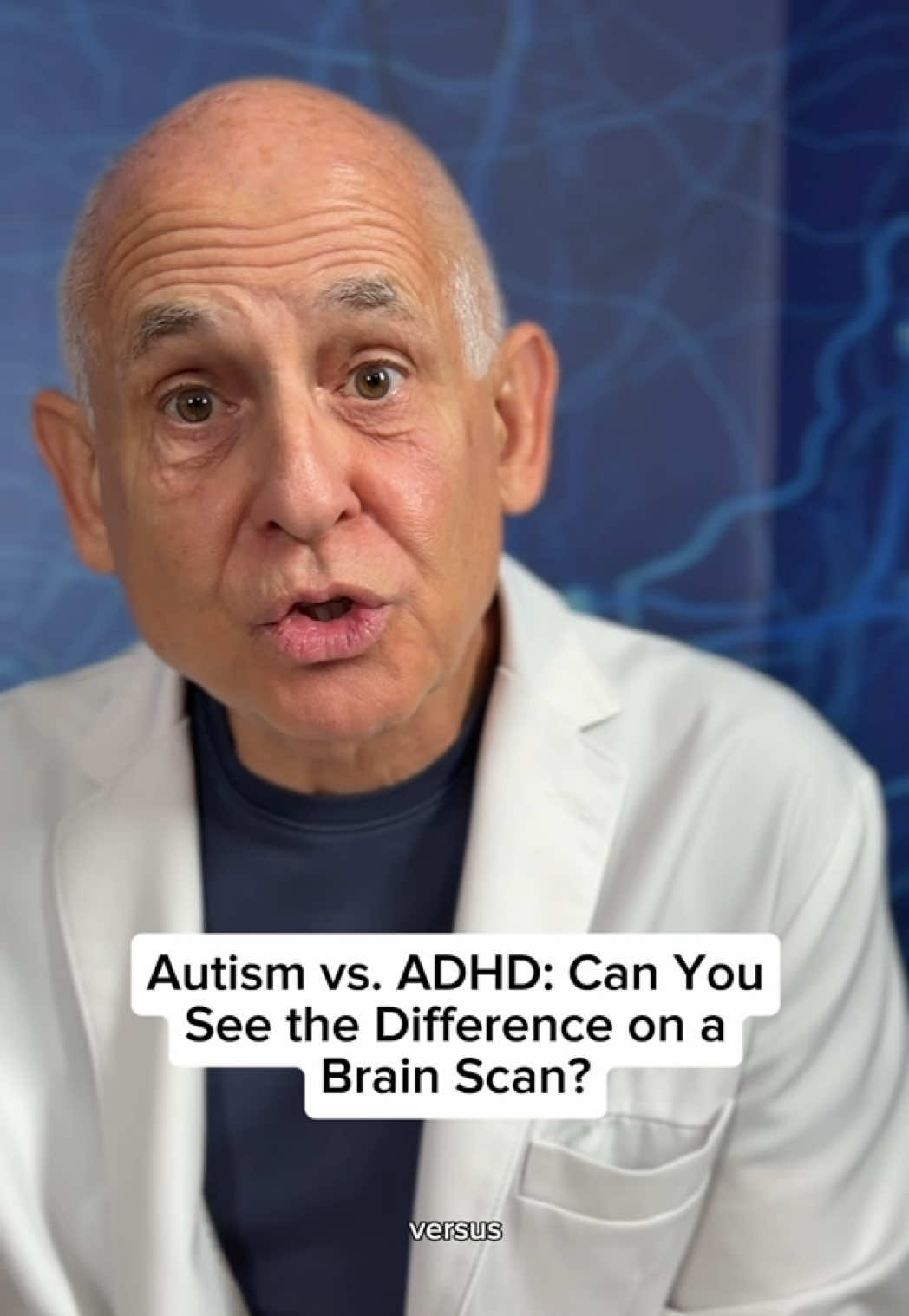 @BrainMD