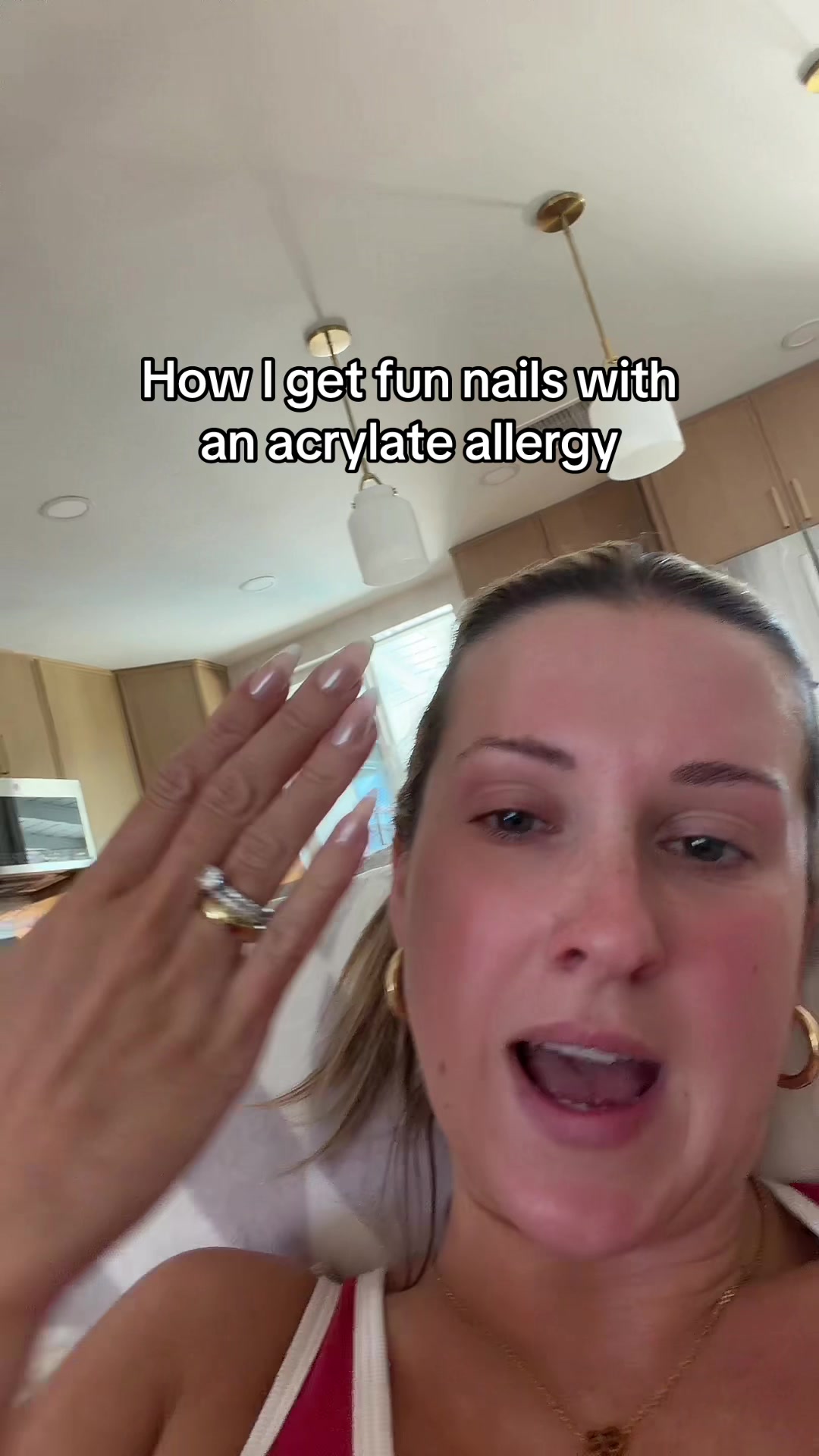 @allergygirl