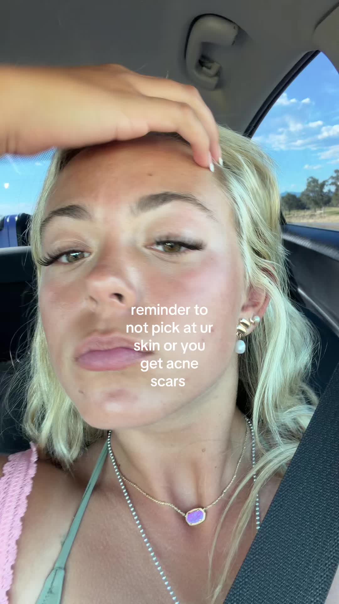 @els