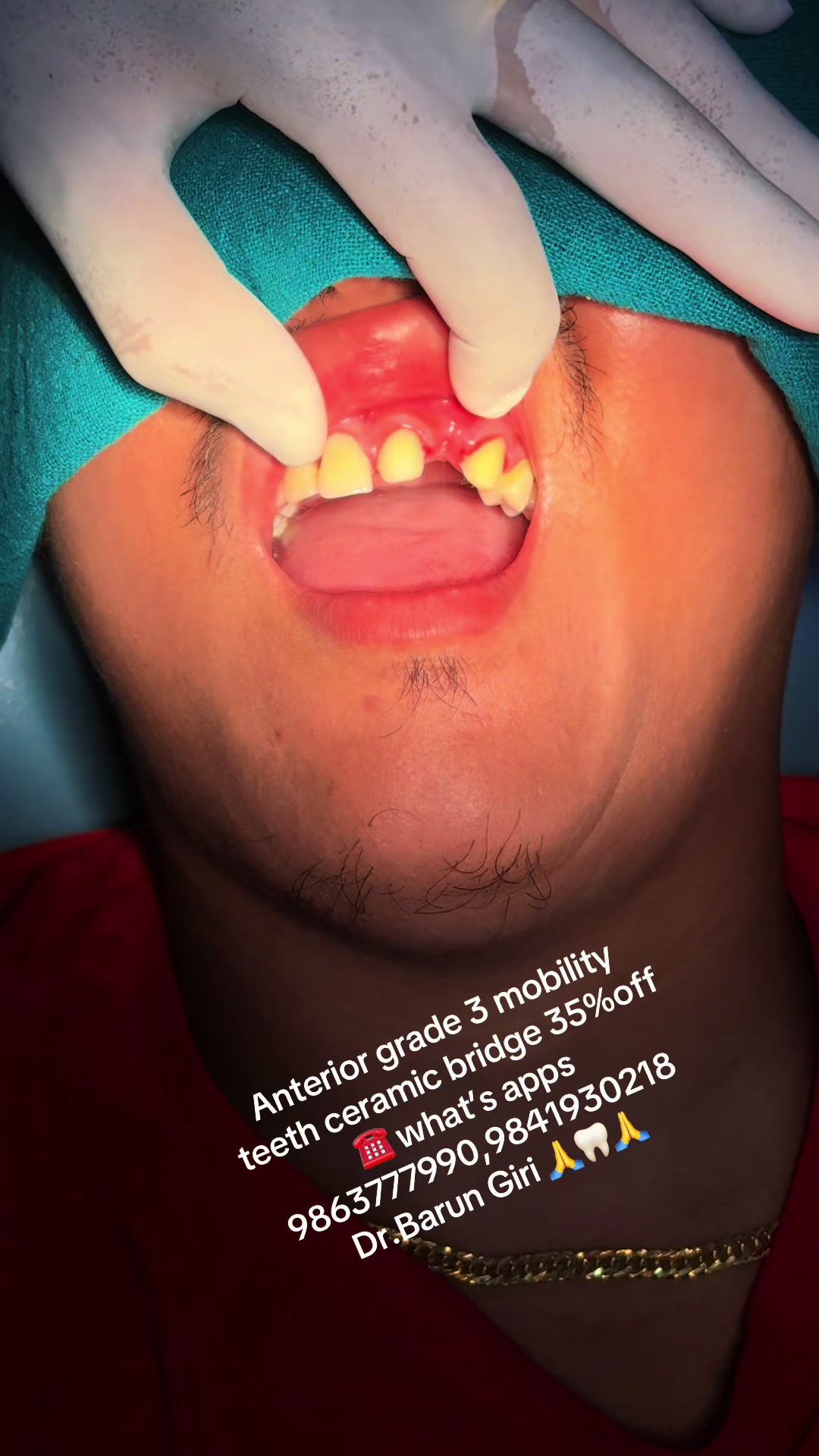 @Unique dental clinic Chabahil
