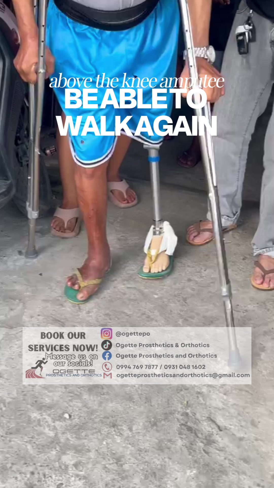 @Ogette Prosthetics & Orthotics