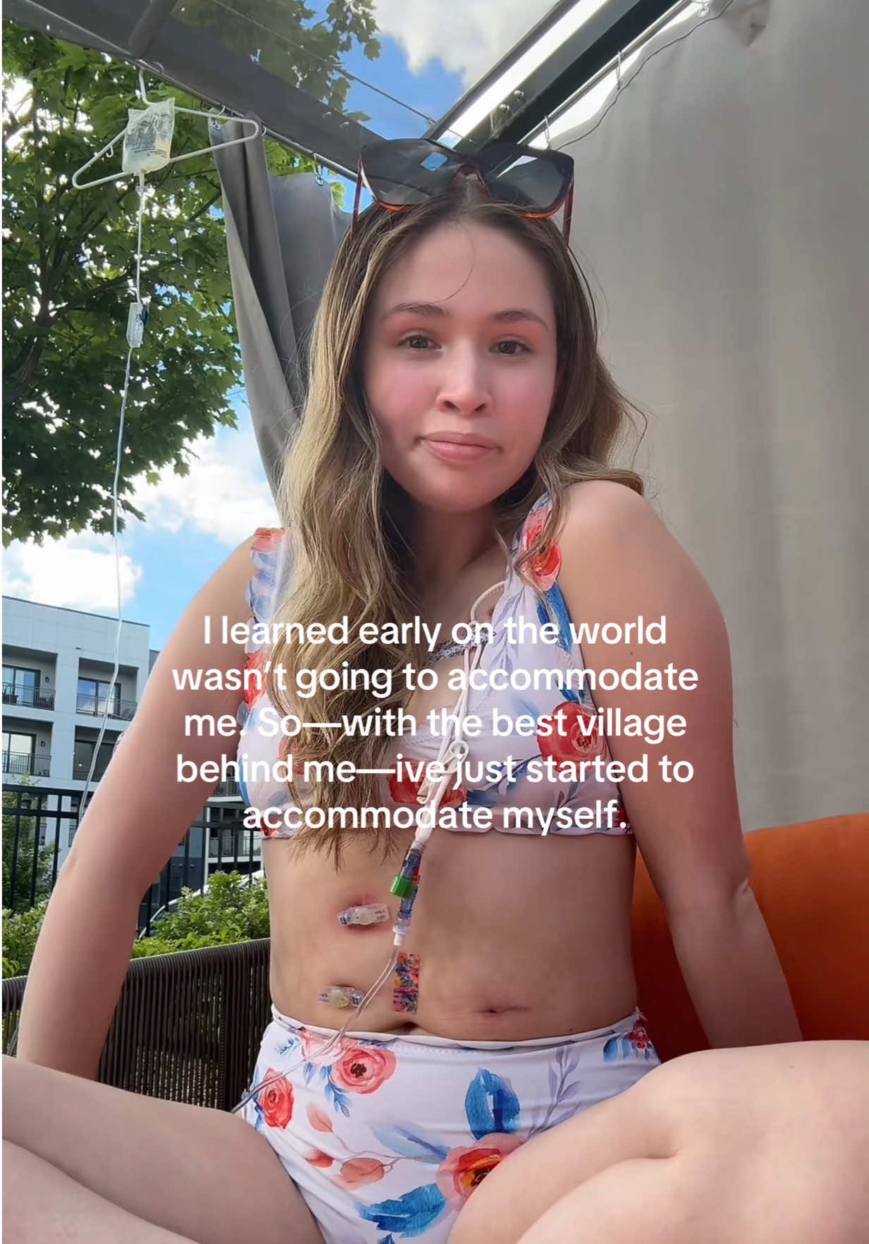 @Alexa