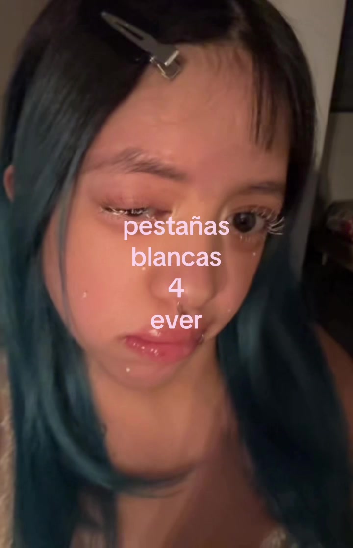 @xi