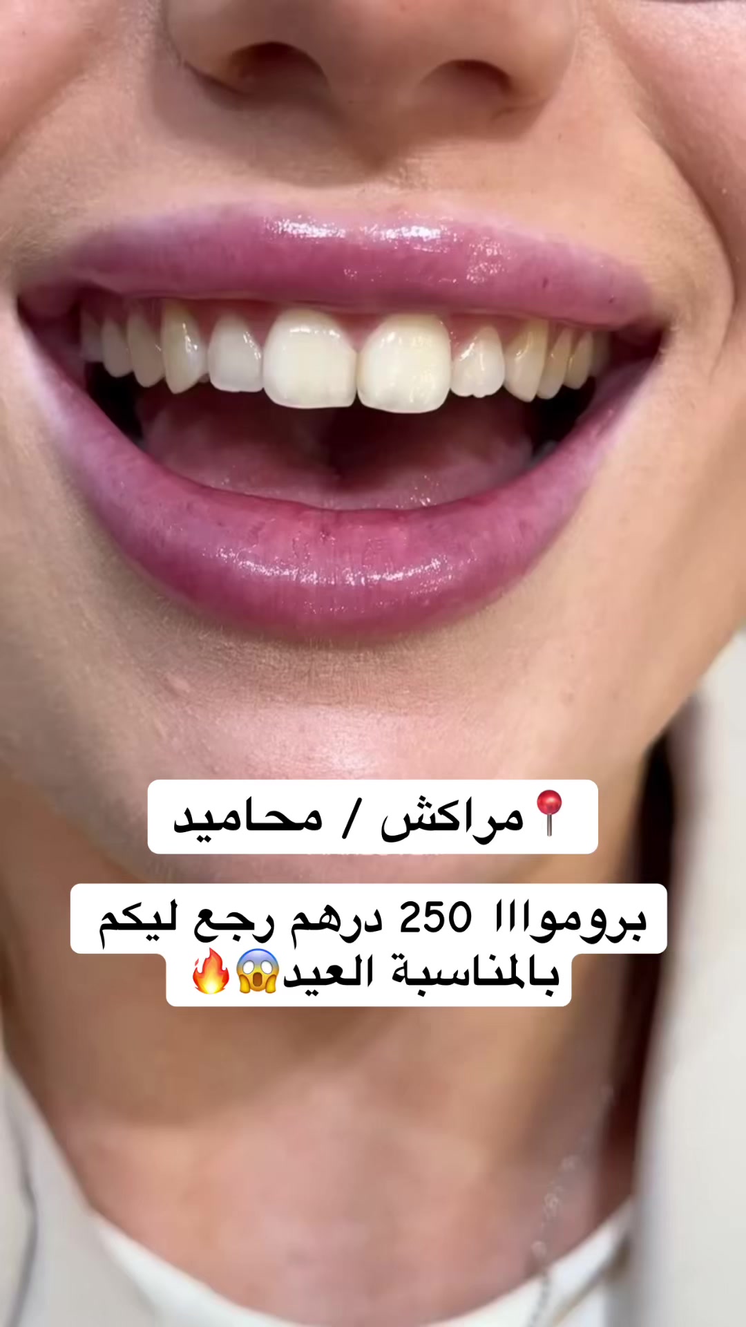 @kldigital.smile