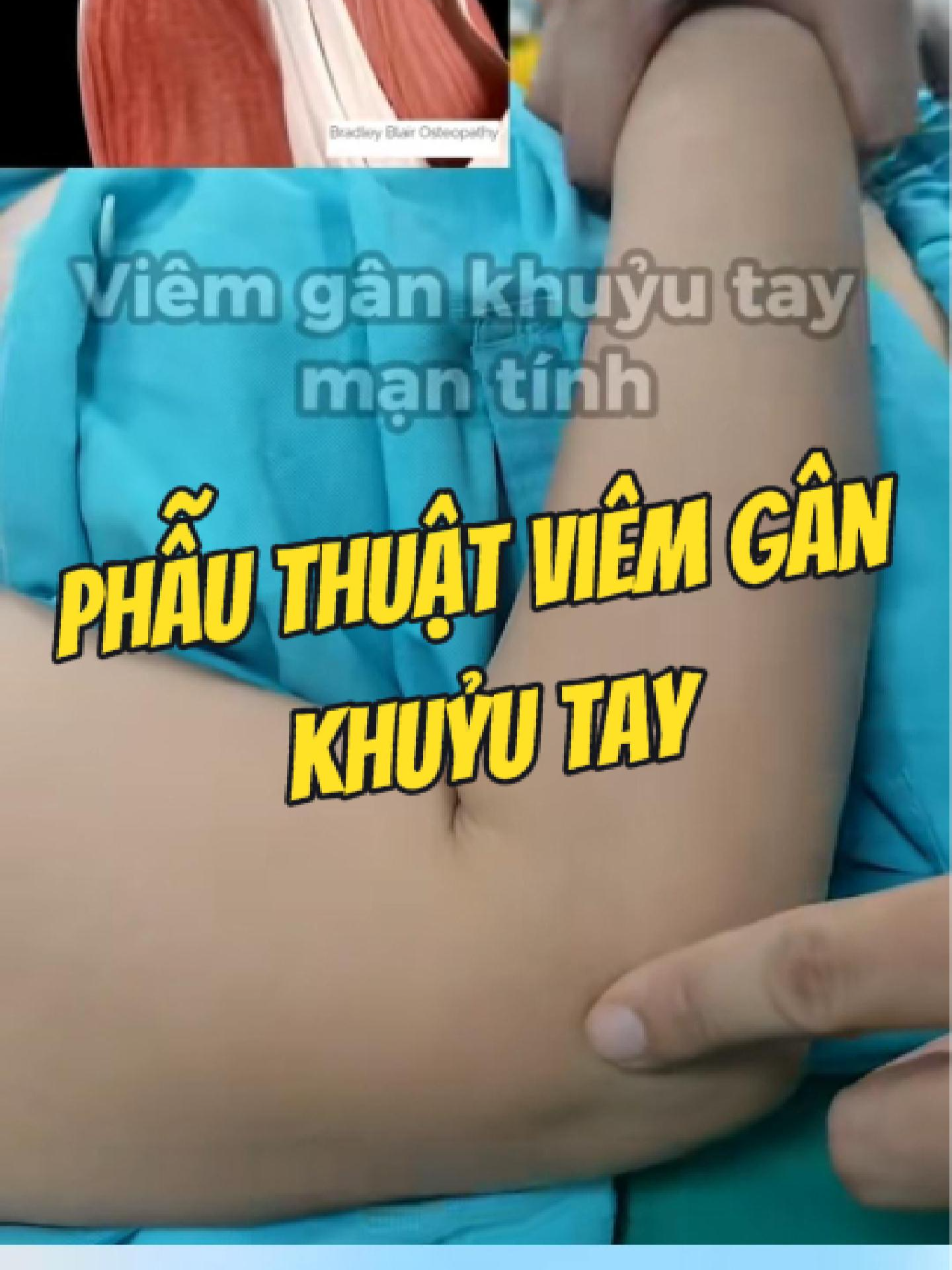 @Chuy&ecirc;n gia xương khớp