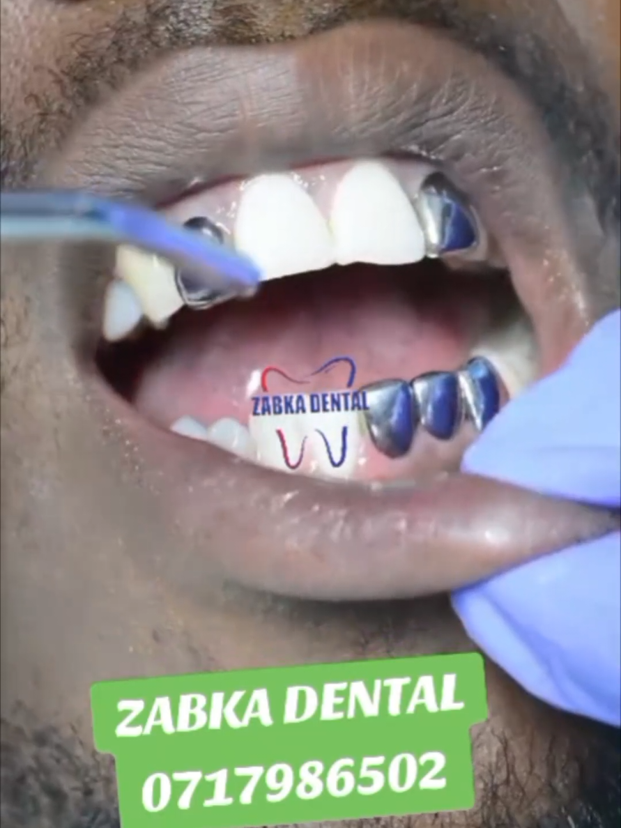 @Zabka Dental