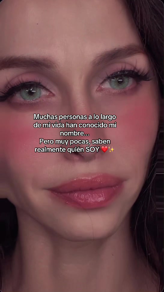 @Dayran 🥴