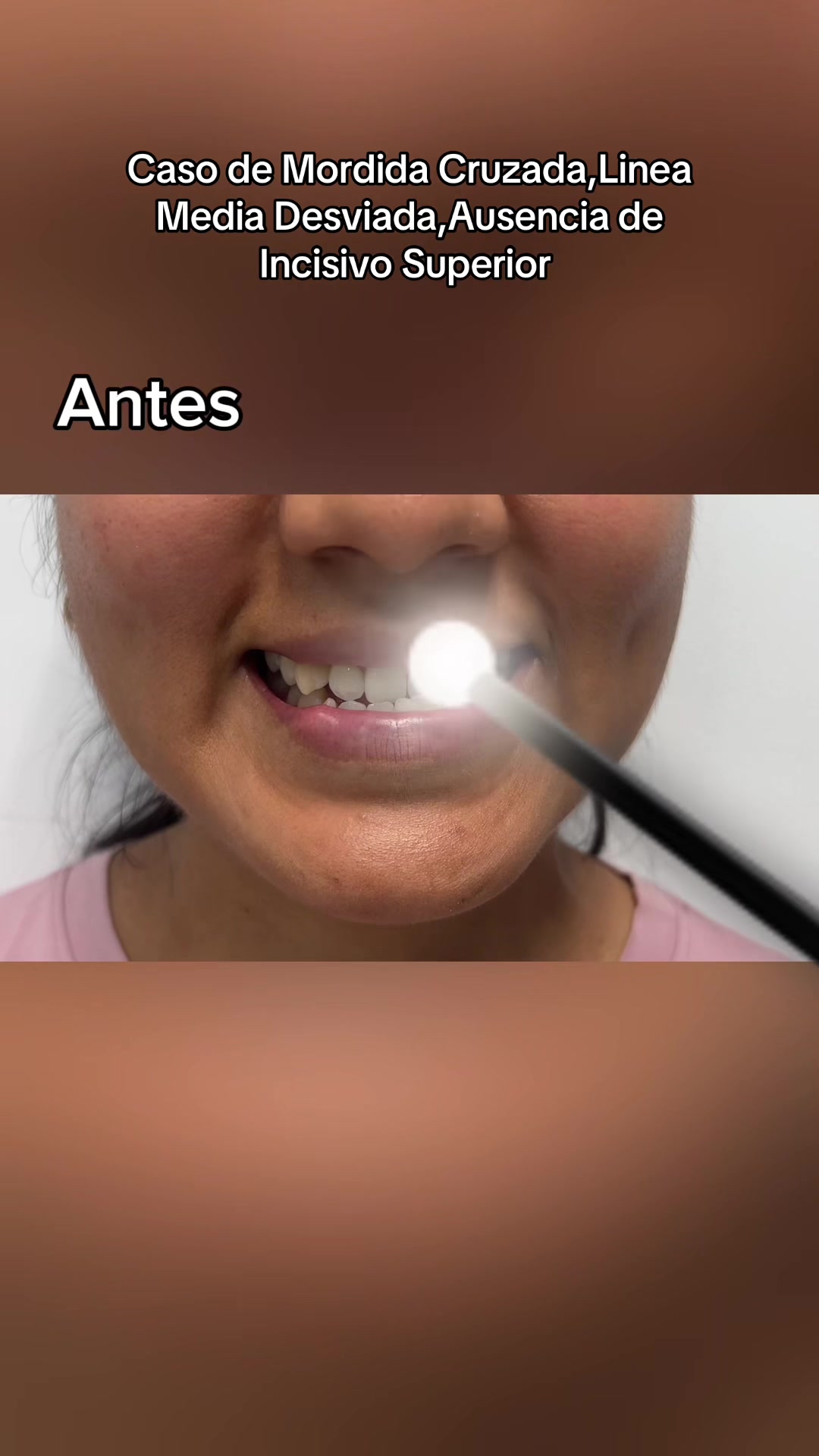 @DentikaBrackets