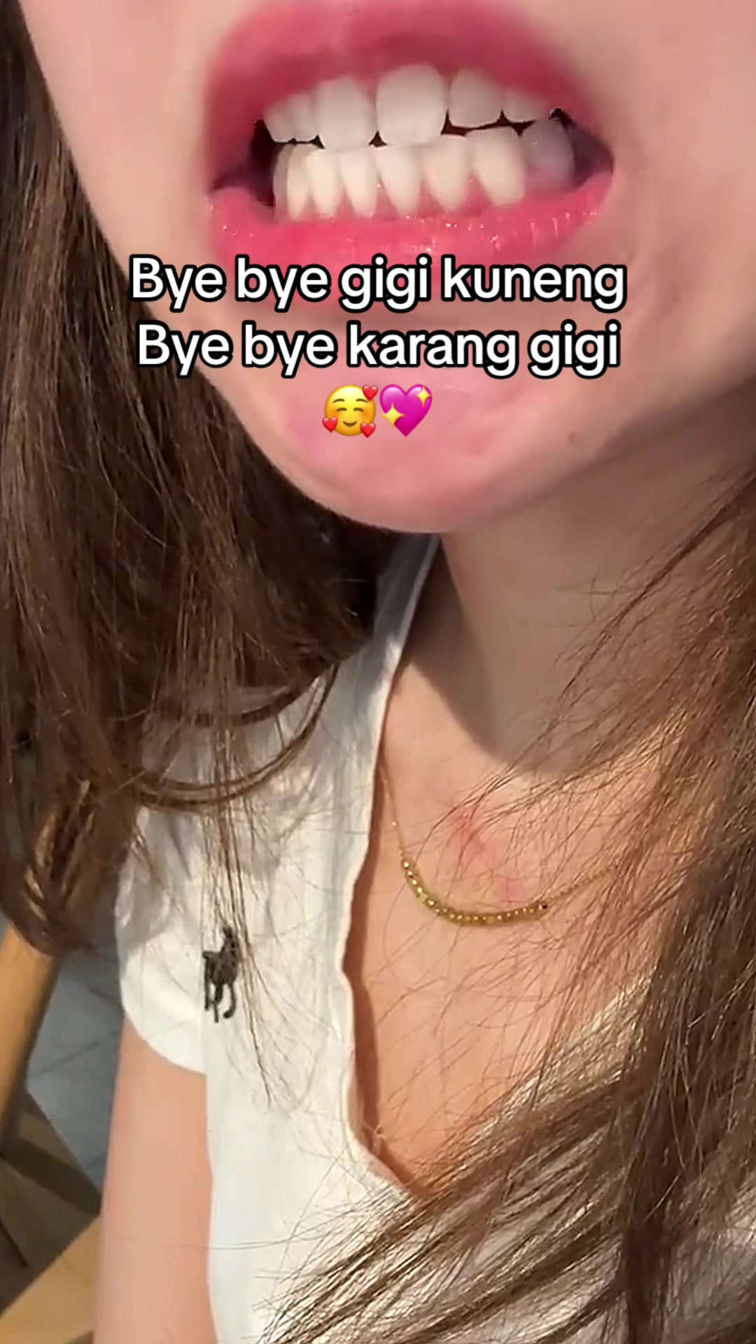 @Gigi Putih Berkilau🦷✨