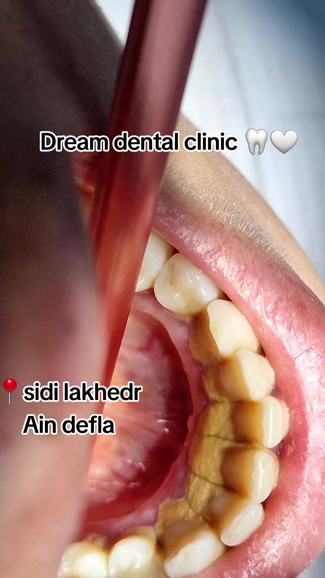 @Dr otmani. A 🦷🖤