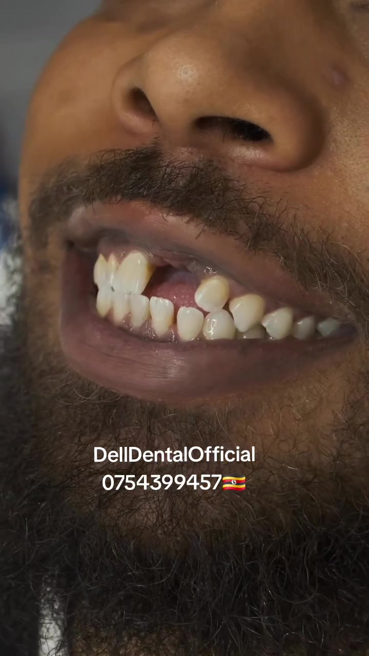 @DellDentalOfficial