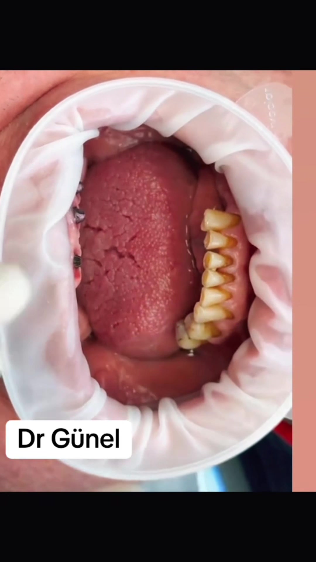 @Dentist_Günel