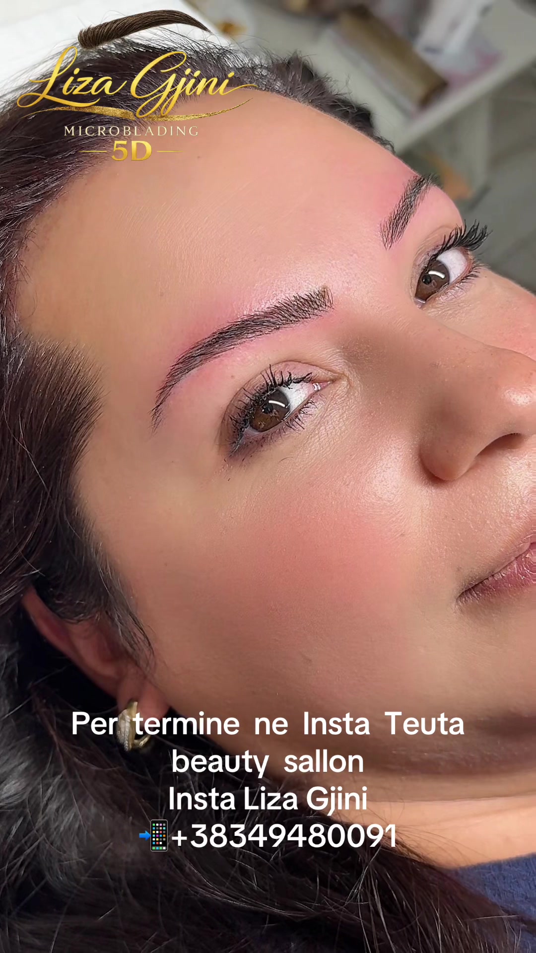 @Liza Gjini Teuta Beauty Center