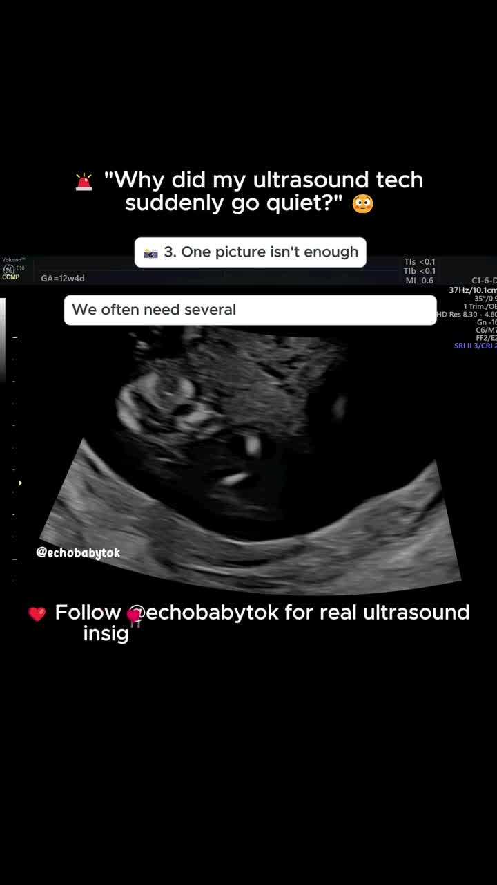 @Echobaby