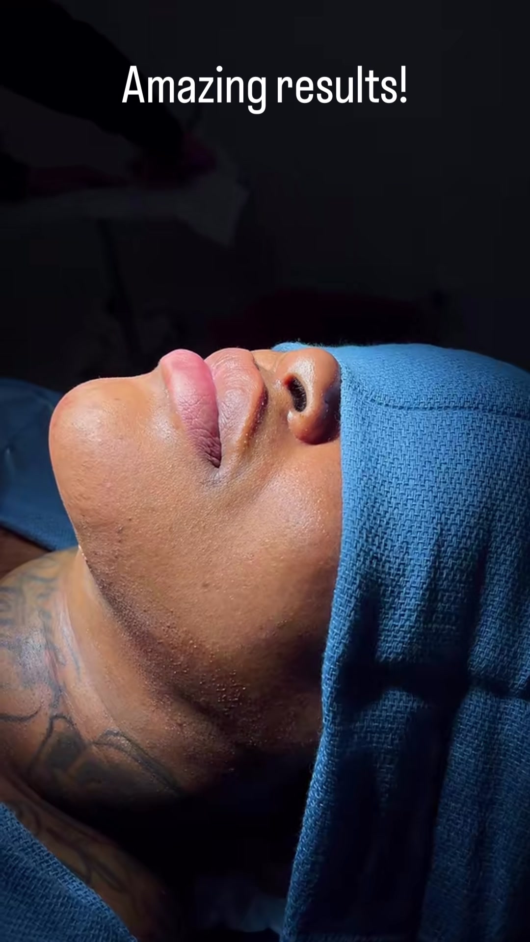 @BioAesthetic305
