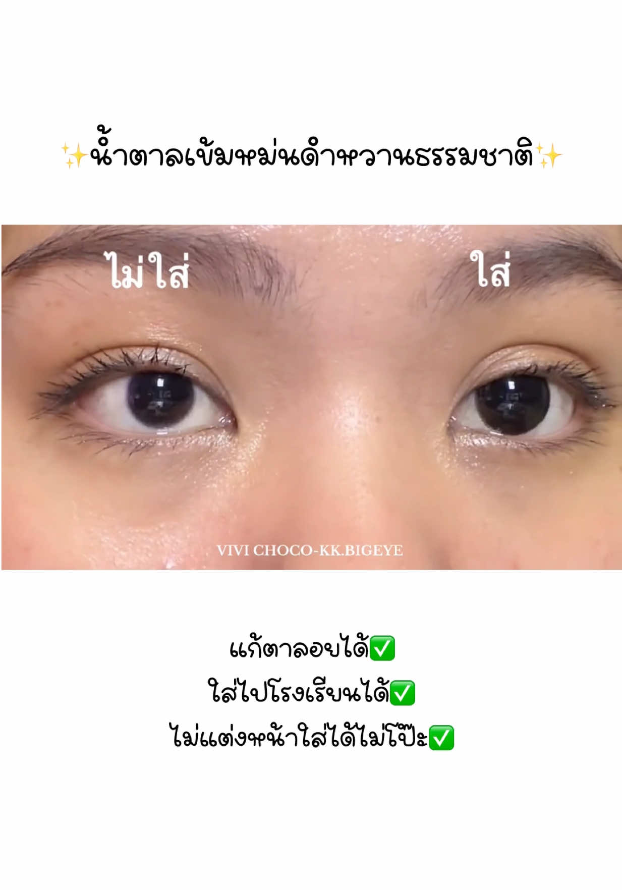 @KK.Bigeye