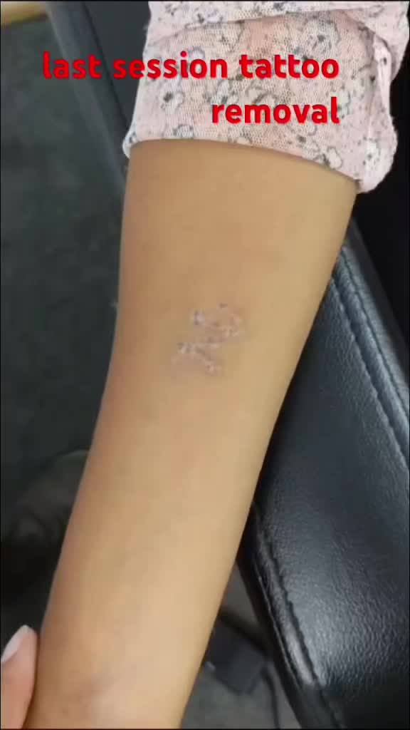 @Sk-susmita tatto&lejar parlar