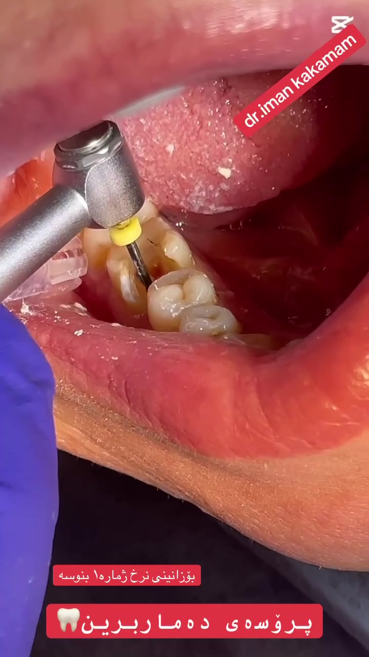@🦷 دکتۆرە ئیمان کاکەمەم