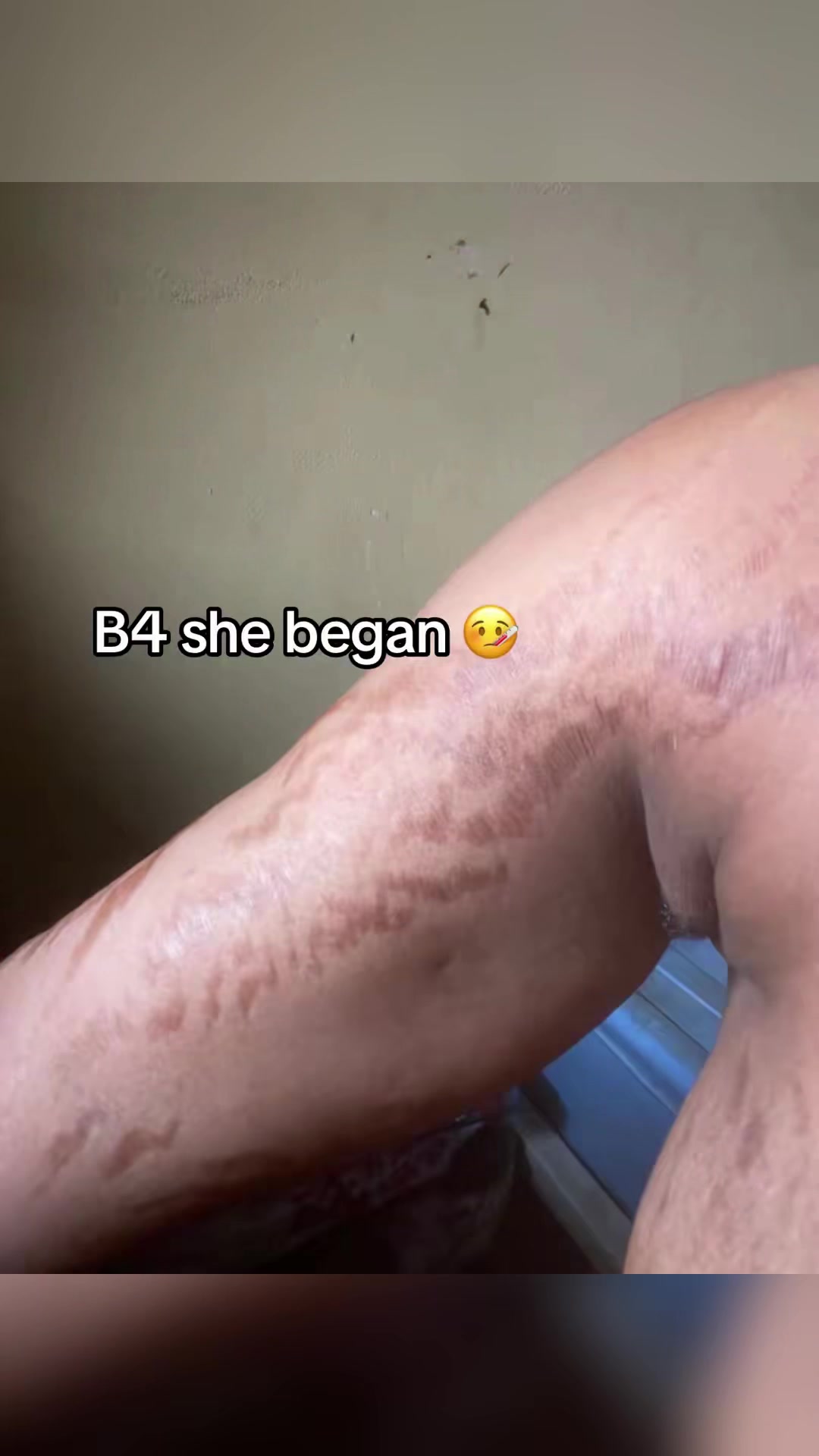 @Radiant skin