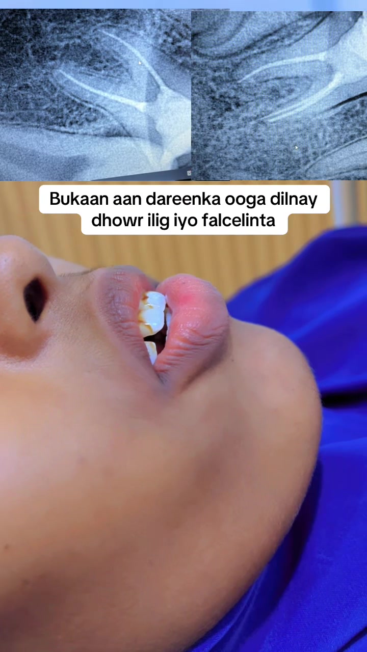 @Dr Abdirahman hassan laari