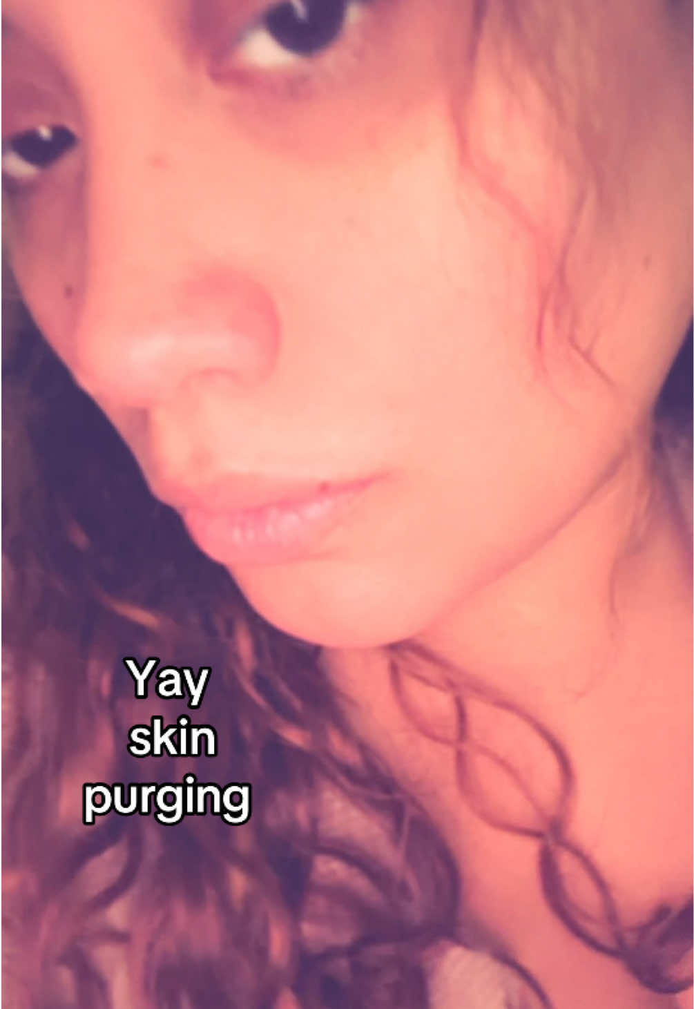 @Kika