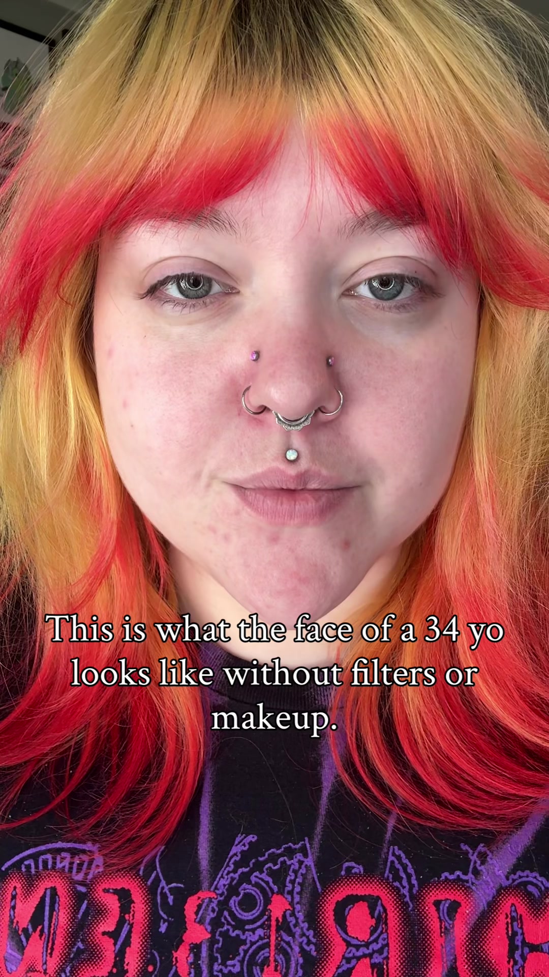 @Ash ๐