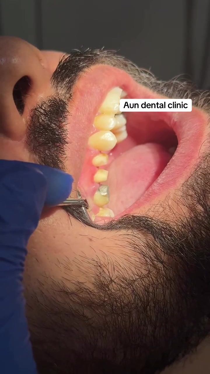 @Aun dental clinic ❤️
