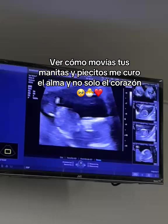 @Maciel