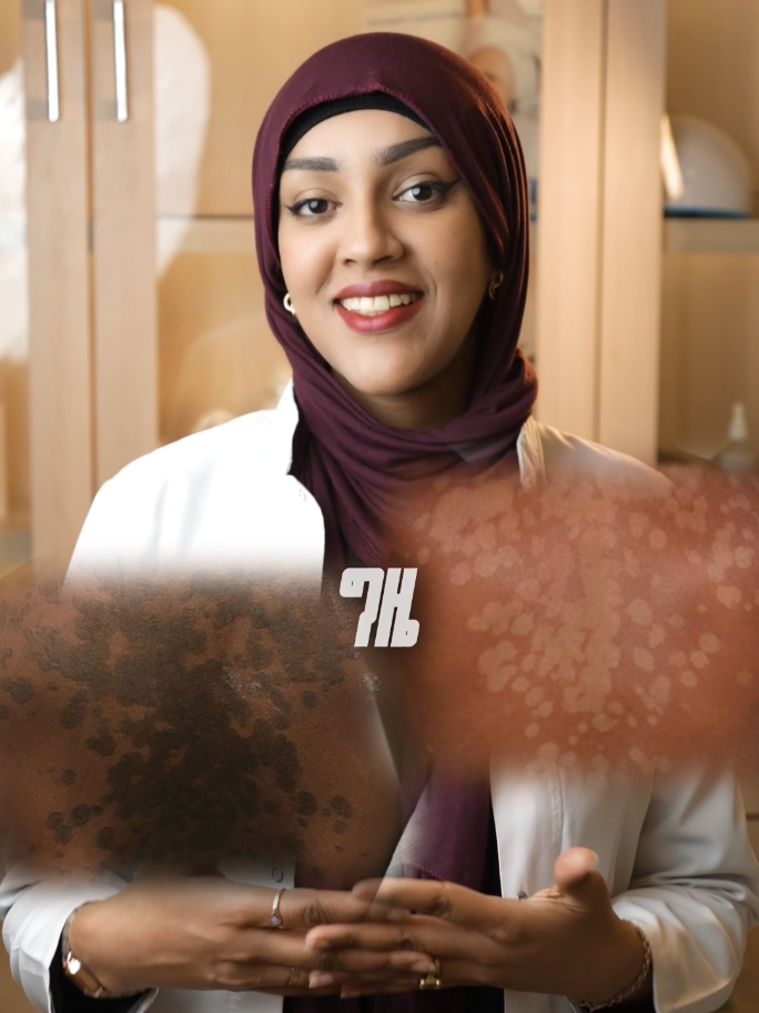 @HUDERMA