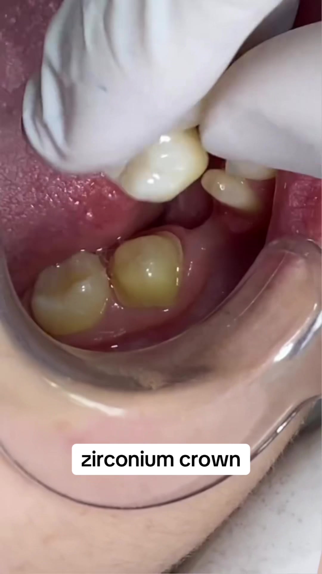 @Aun dental clinic ❤️
