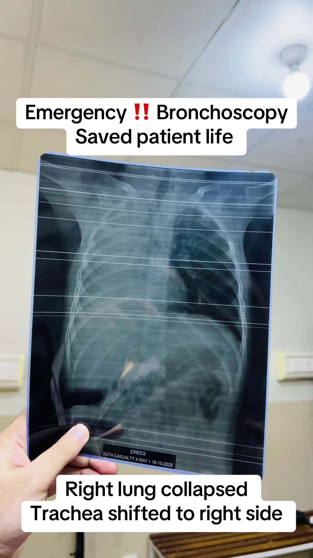 @Dr Tufail khan | ENT Surgeon