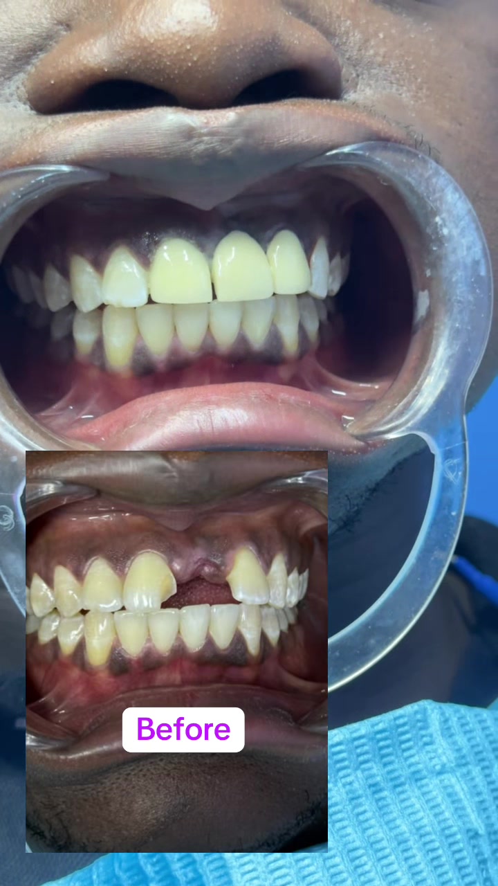@THE SMILEY DENTAL KE